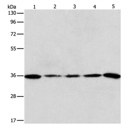 AURKC Antibody from Signalway Antibody (37365) - Antibodies.com