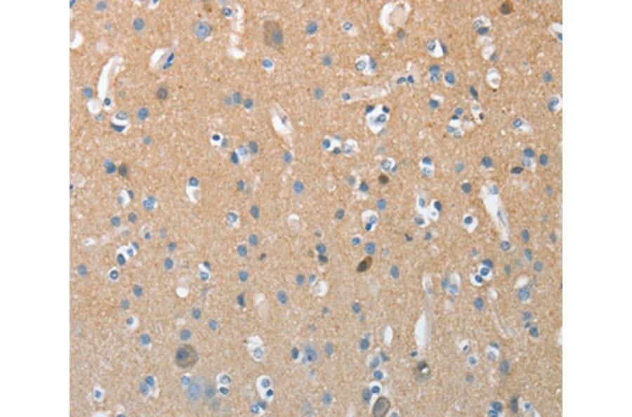 Immunohistochemistry - AURKC Antibody from Signalway Antibody (37365) - Antibodies.com