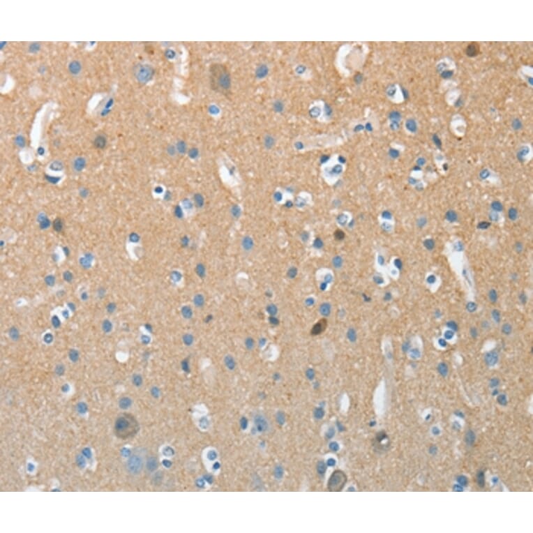 Immunohistochemistry - AURKC Antibody from Signalway Antibody (37365) - Antibodies.com