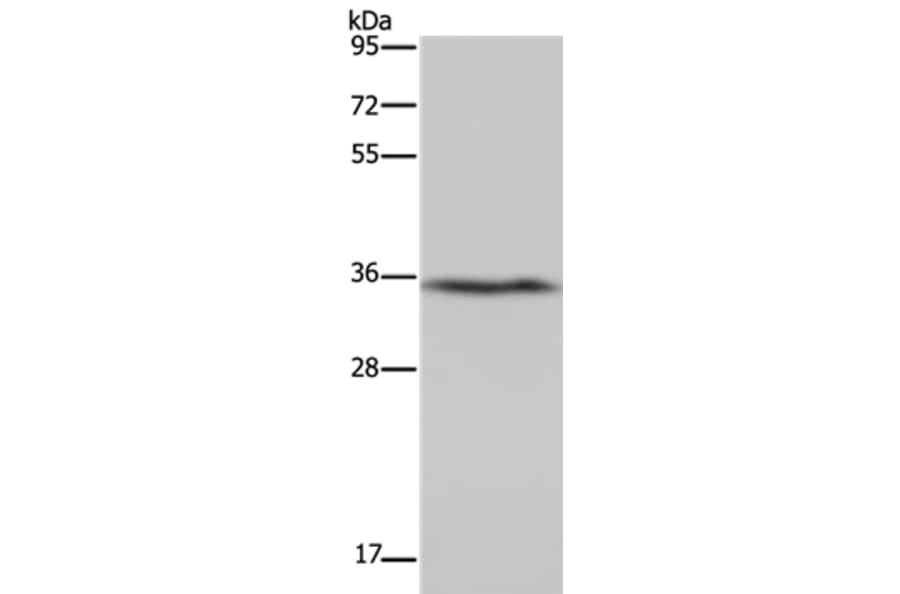 DDAH1 Antibody from Signalway Antibody (37368) - Antibodies.com