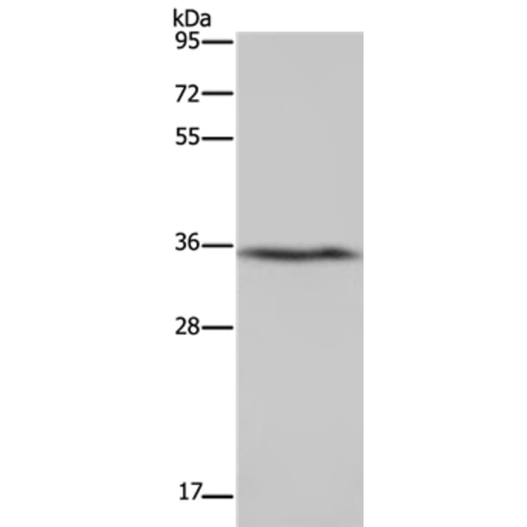 DDAH1 Antibody from Signalway Antibody (37368) - Antibodies.com