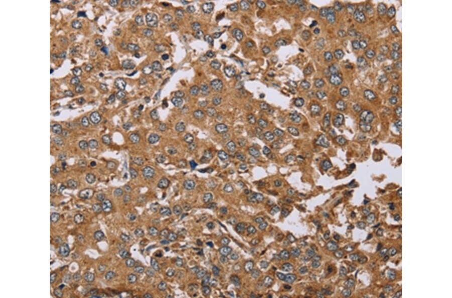 Immunohistochemistry - DDAH1 Antibody from Signalway Antibody (37368) - Antibodies.com