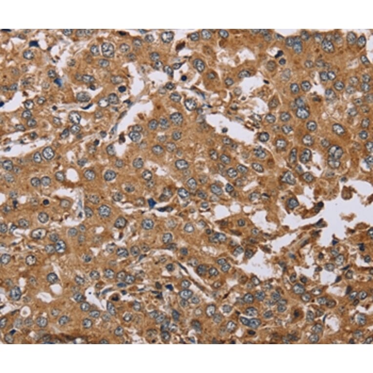 Immunohistochemistry - DDAH1 Antibody from Signalway Antibody (37368) - Antibodies.com