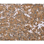 Immunohistochemistry - DDAH1 Antibody from Signalway Antibody (37368) - Antibodies.com