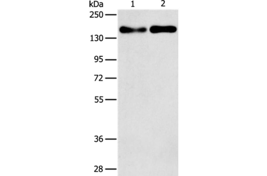 THBS1 Antibody from Signalway Antibody (37384) - Antibodies.com