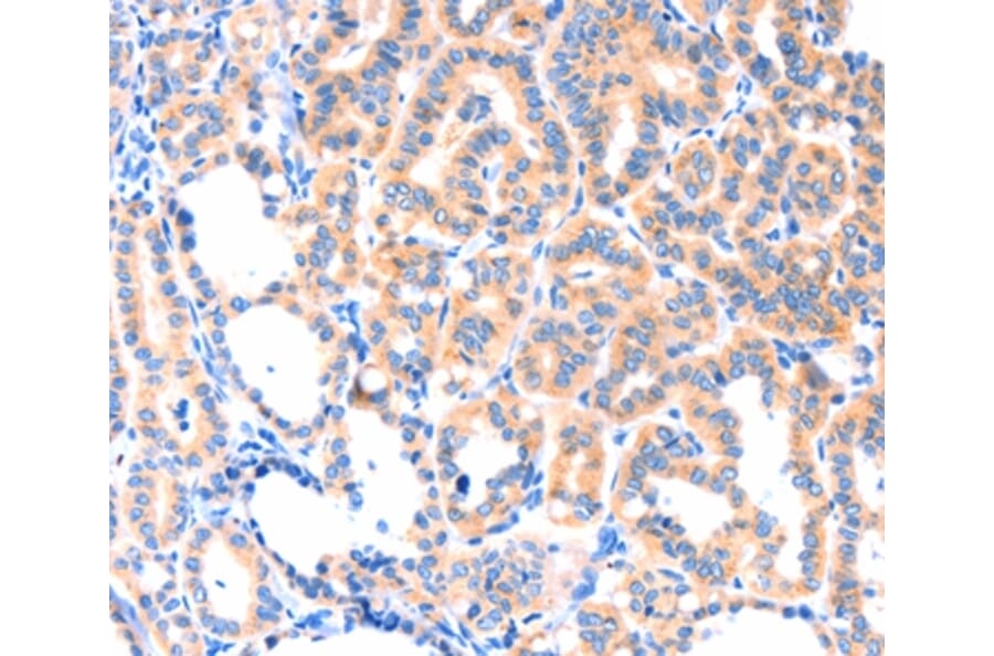Immunohistochemistry - THBS1 Antibody from Signalway Antibody (37384) - Antibodies.com