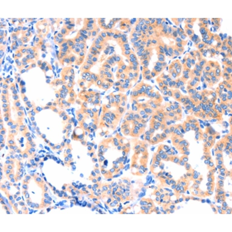 Immunohistochemistry - THBS1 Antibody from Signalway Antibody (37384) - Antibodies.com