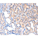 Immunohistochemistry - THBS1 Antibody from Signalway Antibody (37384) - Antibodies.com