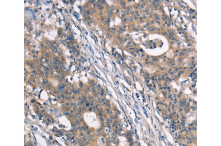 Immunohistochemistry - NDNL2 Antibody from Signalway Antibody (37388) - Antibodies.com