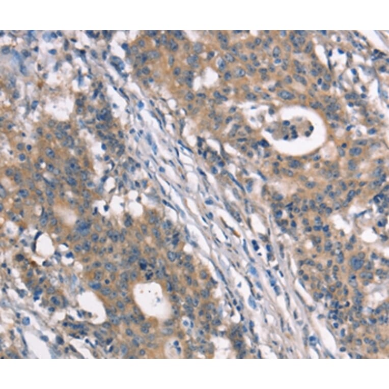 Immunohistochemistry - NDNL2 Antibody from Signalway Antibody (37388) - Antibodies.com