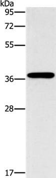 Gel: 10% SDS-PAGE Lysate: 40ug HepG2 cell Primary antibody: 1/1400 dilution Secondary antibody dilution: 1/8000 Exposure time: 40 seconds