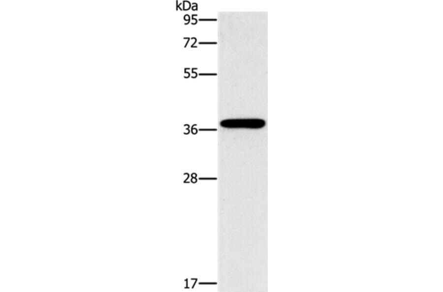 MARC1 Antibody from Signalway Antibody (37390) - Antibodies.com