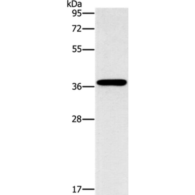 MARC1 Antibody from Signalway Antibody (37390) - Antibodies.com