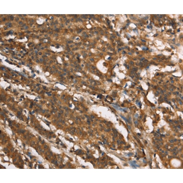 Immunohistochemistry - MARC1 Antibody from Signalway Antibody (37390) - Antibodies.com