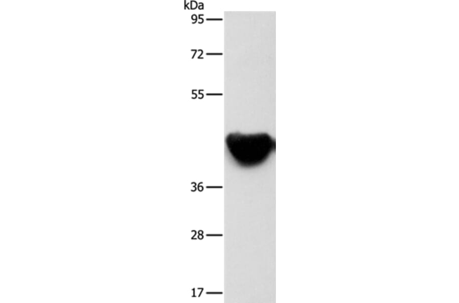 ACTA2 Antibody from Signalway Antibody (37408) - Antibodies.com