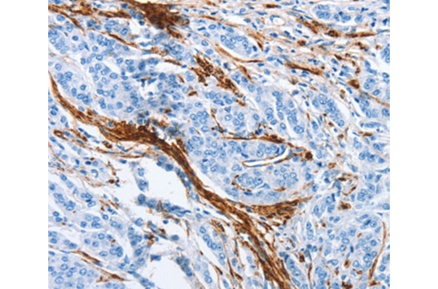 Immunohistochemistry - ACTA2 Antibody from Signalway Antibody (37408) - Antibodies.com