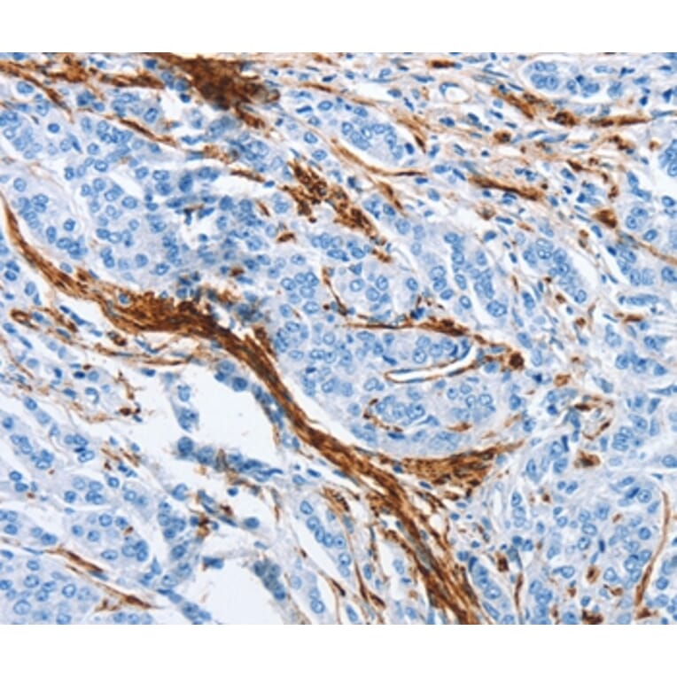 Immunohistochemistry - ACTA2 Antibody from Signalway Antibody (37408) - Antibodies.com