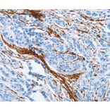 Immunohistochemistry - ACTA2 Antibody from Signalway Antibody (37408) - Antibodies.com