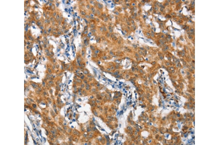 Immunohistochemistry - STAT2 Antibody from Signalway Antibody (37417) - Antibodies.com