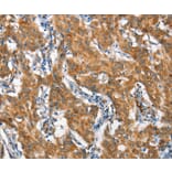 Immunohistochemistry - STAT2 Antibody from Signalway Antibody (37417) - Antibodies.com