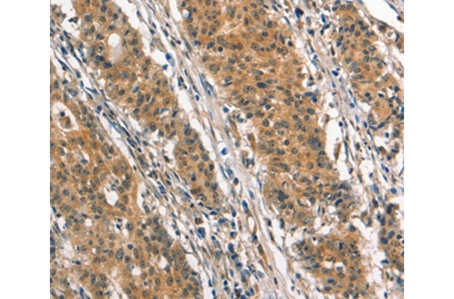 Immunohistochemistry - SMAD3 Antibody from Signalway Antibody (37418) - Antibodies.com