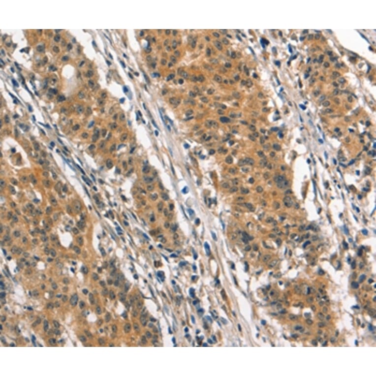 Immunohistochemistry - SMAD3 Antibody from Signalway Antibody (37418) - Antibodies.com