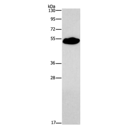 SMAD9 Antibody from Signalway Antibody (37419) - Antibodies.com