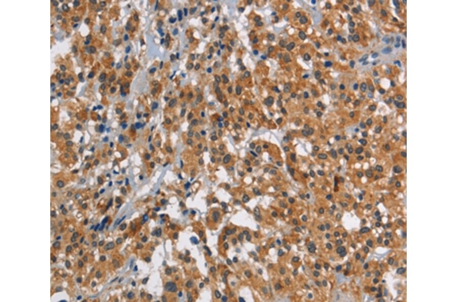 Immunohistochemistry - SMAD9 Antibody from Signalway Antibody (37419) - Antibodies.com