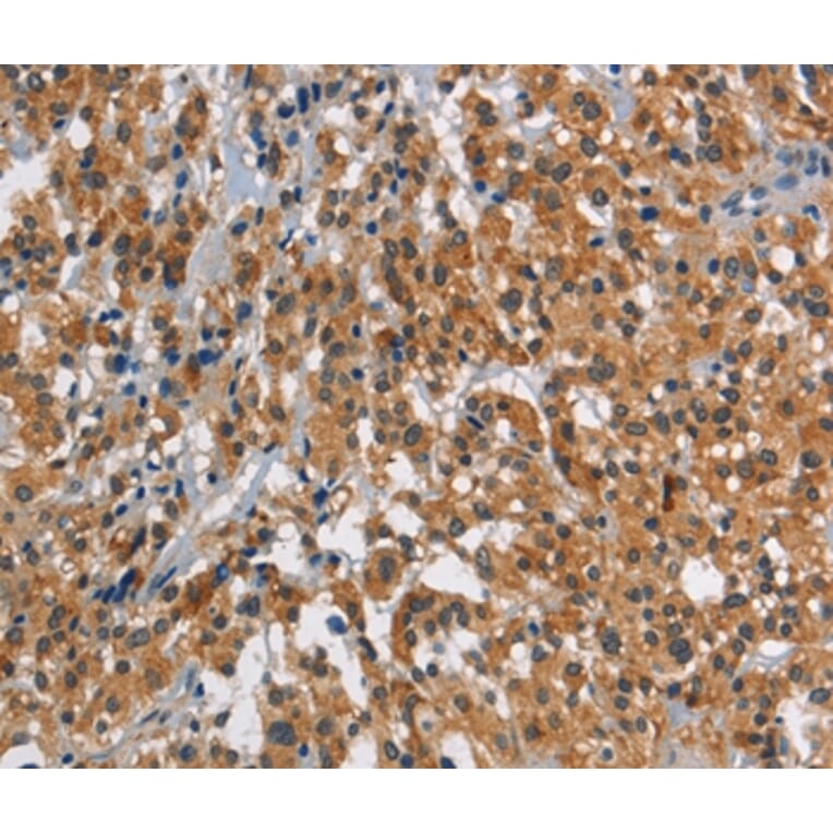 Immunohistochemistry - SMAD9 Antibody from Signalway Antibody (37419) - Antibodies.com