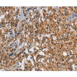 Immunohistochemistry - SMAD9 Antibody from Signalway Antibody (37419) - Antibodies.com