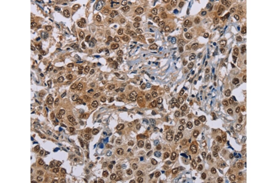 Immunohistochemistry - GTF2I Antibody from Signalway Antibody (37440) - Antibodies.com