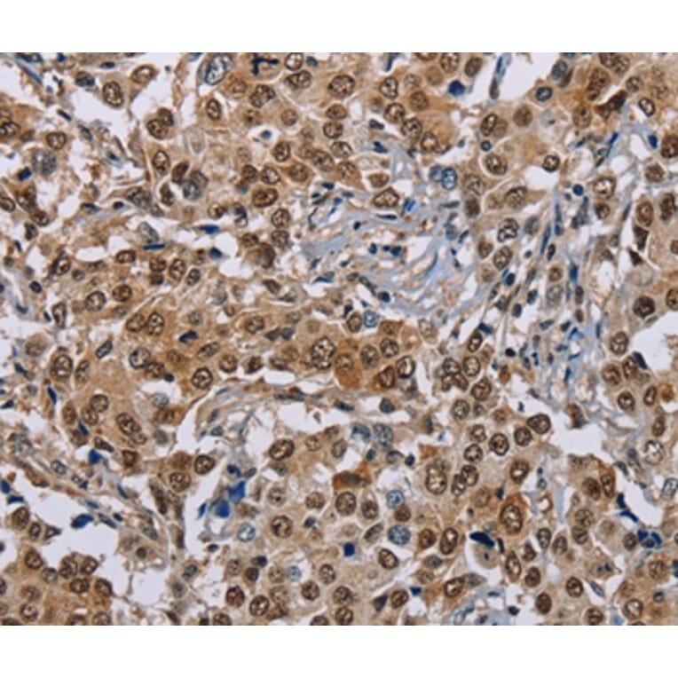 Immunohistochemistry - GTF2I Antibody from Signalway Antibody (37440) - Antibodies.com