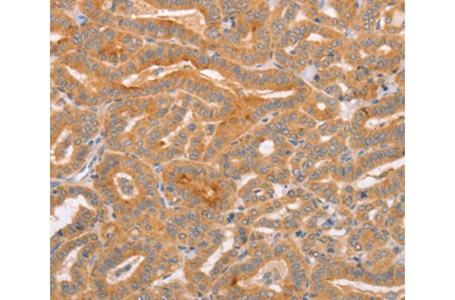 Immunohistochemistry - CD2AP Antibody from Signalway Antibody (37468) - Antibodies.com