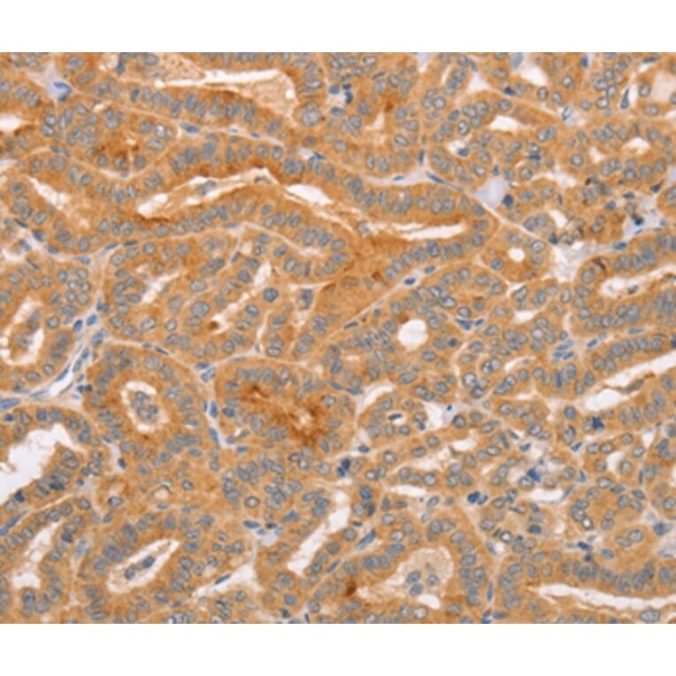 Immunohistochemistry - CD2AP Antibody from Signalway Antibody (37468) - Antibodies.com
