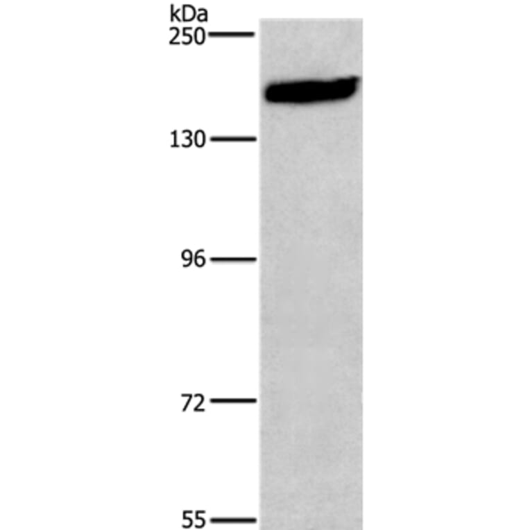 NCAM1 Antibody from Signalway Antibody (37476) - Antibodies.com