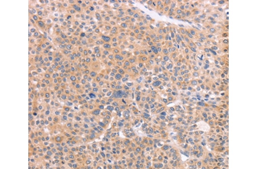 Immunohistochemistry - NCAM1 Antibody from Signalway Antibody (37476) - Antibodies.com