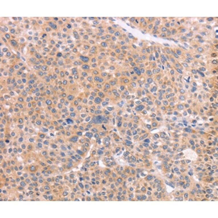 Immunohistochemistry - NCAM1 Antibody from Signalway Antibody (37476) - Antibodies.com