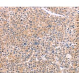 Immunohistochemistry - NCAM1 Antibody from Signalway Antibody (37476) - Antibodies.com