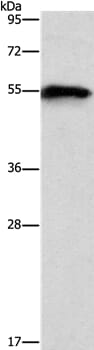 Gel: 6%SDS-PAGE Lysates (from left to right): Mouse heart tissue Amount of lysate: 40ug per lane Primary antibody: 1/1000 dilution Secondary antibody dilution: 1/8000 Exposure time: 3 seconds