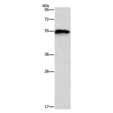 CDK19 Antibody from Signalway Antibody (37480) - Antibodies.com