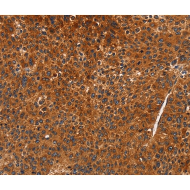 Immunohistochemistry - CDK19 Antibody from Signalway Antibody (37480) - Antibodies.com