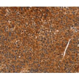 Immunohistochemistry - CDK19 Antibody from Signalway Antibody (37480) - Antibodies.com