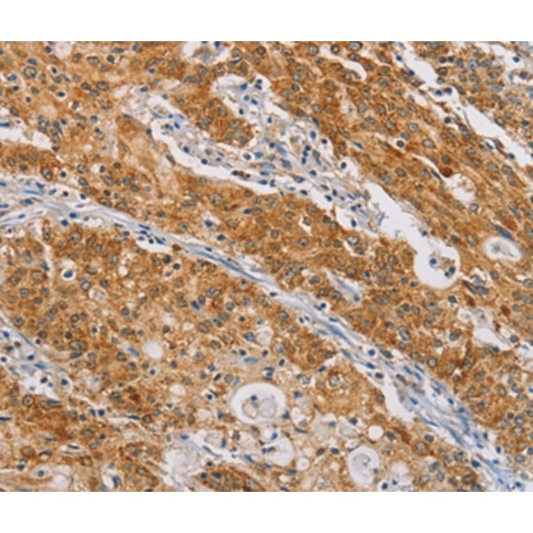 Immunohistochemistry - CENPE Antibody from Signalway Antibody (37482) - Antibodies.com
