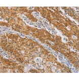Immunohistochemistry - CENPE Antibody from Signalway Antibody (37482) - Antibodies.com