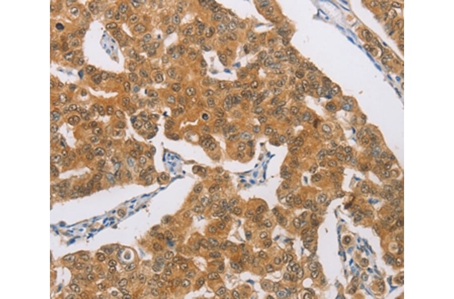 Immunohistochemistry - AGAP2 Antibody from Signalway Antibody (37484) - Antibodies.com