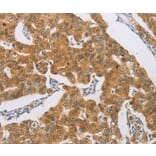 Immunohistochemistry - AGAP2 Antibody from Signalway Antibody (37484) - Antibodies.com