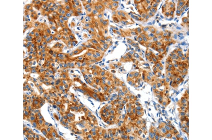 Immunohistochemistry - CKAP4 Antibody from Signalway Antibody (37490) - Antibodies.com