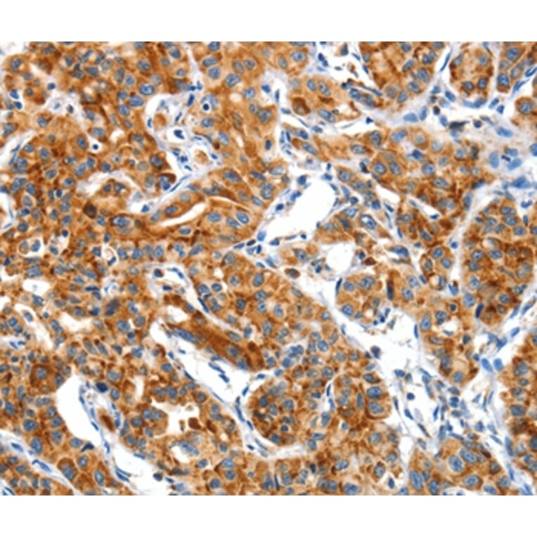 Immunohistochemistry - CKAP4 Antibody from Signalway Antibody (37490) - Antibodies.com