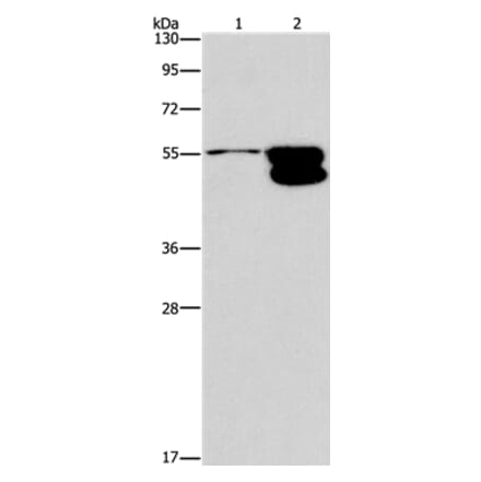 CRHR2 Antibody from Signalway Antibody (37504) - Antibodies.com