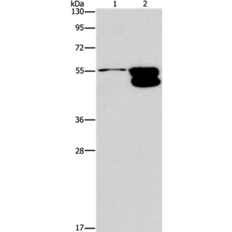 CRHR2 Antibody from Signalway Antibody (37504) - Antibodies.com